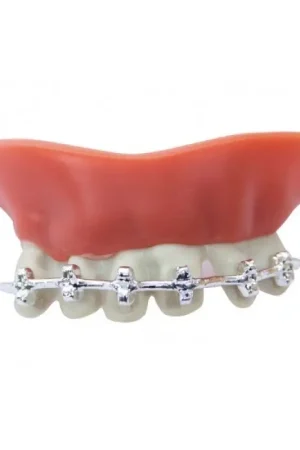Dentier Avec Appareil Dentaire Vente Flash