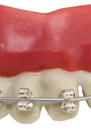 Dentier Appareil Dentaire Super Prix