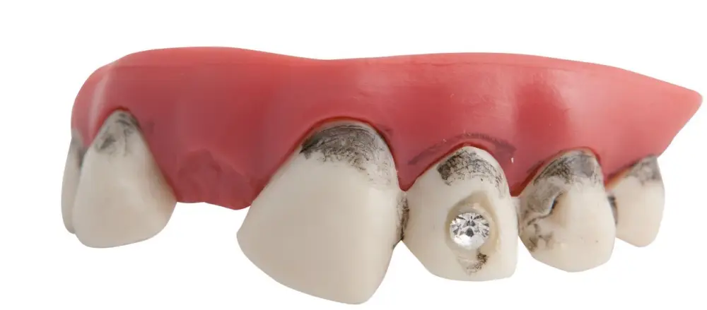 Dentier Vieilles Dents et Faux Diamant Certifié
